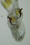 Mompha subbistrigella