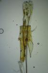 Chionodes distinctella