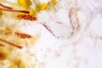 Coleophora eupreta