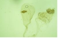 Agonopterix scopariella