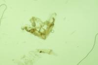 Coleophora texanella