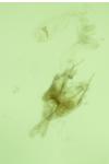 Coleophora texanella