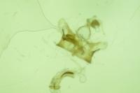 Coleophora acutiphaga