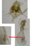 Acleris schalleriana