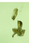 Metzneria metzneriella