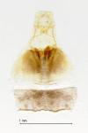 Plutella xylostella