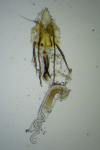 Coleophora otidipennella
