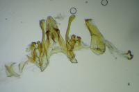 Scrobipalpa
