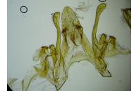 Scrobipalpa