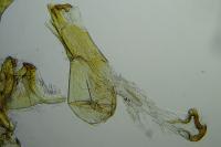 Scrobipalpa