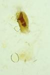 Rhyacionia buoliana