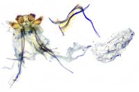 Coptotriche angusticollella