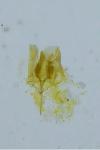 Coptotriche heinemanni