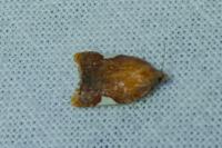 Acleris holmiana