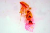 Aethes margarotana