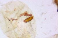Agonopterix