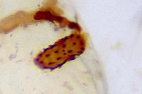 Agonopterix
