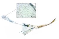 Crassa unitella