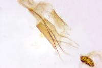 Agnoea