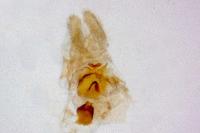 Aethes margarotana