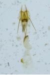 Coleophora alticolella