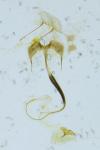 Coleophora betulella