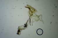 Acleris schalleriana