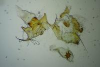Acleris cristana