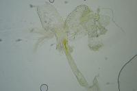 Argyresthia abdominalis