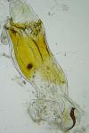 Mompha subbistrigella
