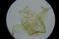 Ectoedemia
