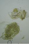 Bucculatrix ulmella