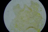 Ectoedemia