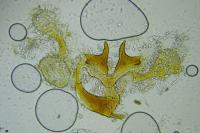 Coleophora serratella
