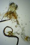 Coleophora vibicella