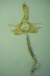 Coleophora coronillae