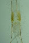 Metzneria neuropterella