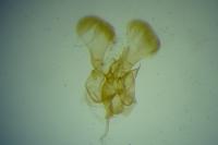 Parornix fagivora