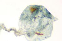 Coleophora saxicolella