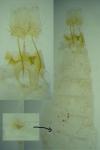 Anarsia bilbainella