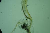 Coleophora trifolii