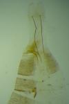 Scrobipalpa