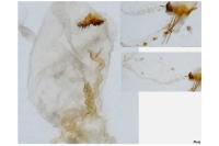 Neofaculta ericetella