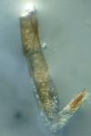 Oegoconia