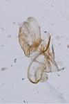 Aproaerema anthyllidella