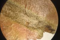 Phyllonorycter mespilella