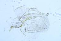 Eteobalea anonymella