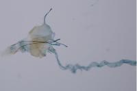 Agnoea