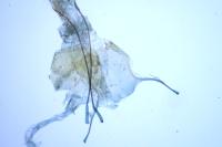 Agnoea