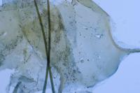Agnoea